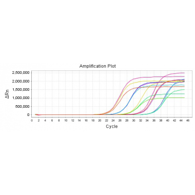 Diagnostic Kit for Chlamydia Trachomatis (CT) & Ureaplasma Urealyticum (UU) (Fluorescence probe RT-PCR)