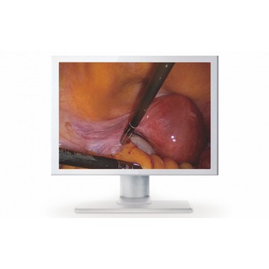 Endoscopic Display