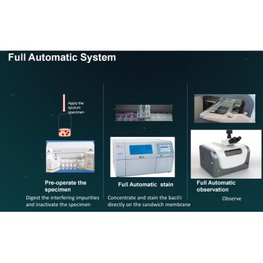 Dedicated in TB diagnostic