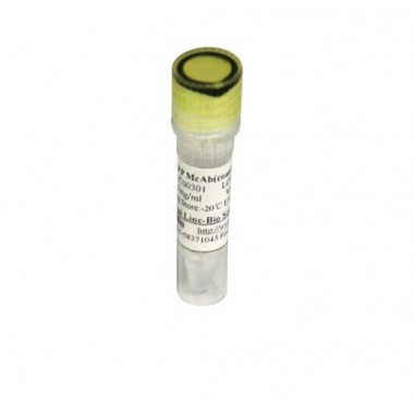 Anti CA72-4 antibody