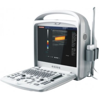 Portable Color Doppler Ultrasound