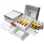 Rheumatoid Arthritis Anti-CCP Detection Kit (ELISA)