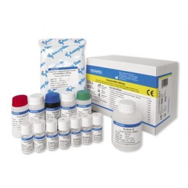 ToxoplasmaEIA-IgG-Avidity