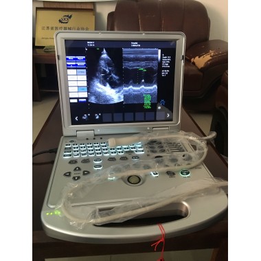 YJ-C60PLUS V2.1  CW Function Color Doppler
