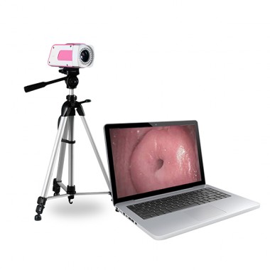 SW- 3303 Digital Colposcope