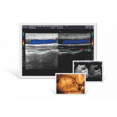 Ultrasound Image Display