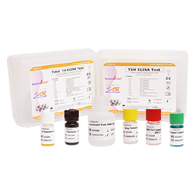 HBsAg ELISA Test