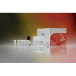 Dynamiker Cryptococcus neoformans Antigen Assay