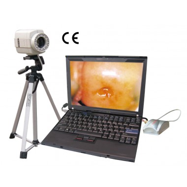 DP-9800 Digital Imaging System video inspecting system colposcope price