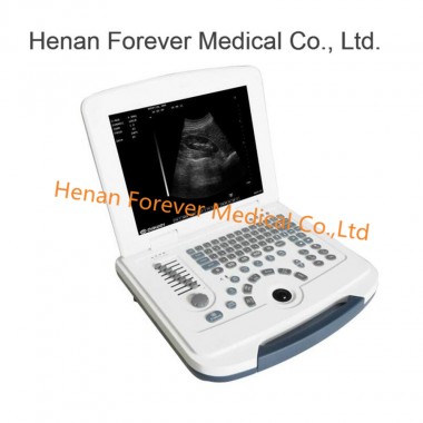 Full-Digital B/W Portable Ultrasound Scanner (YJ-U580)