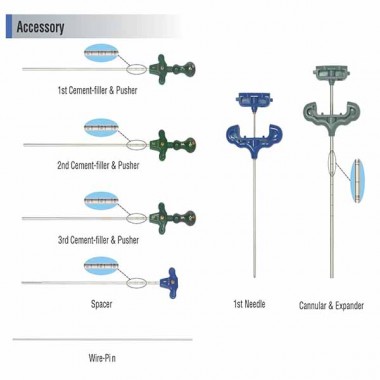 BALEX (Kyphoplasty)