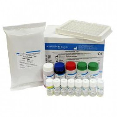 Toxoplasma IgM